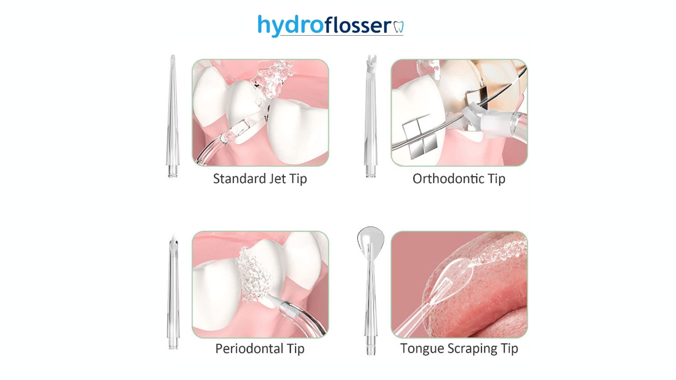 HydroFlosser Features